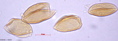 ISEM 1/Ruscus_hipophyllum_29362/Ruscus_hipophyllum_29362_0001(copy)_thumb.jpg